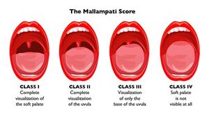 Mallampati Score